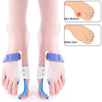 1 Pair ZRWC14 Bunio Night Splint Straightener, ZRWC14