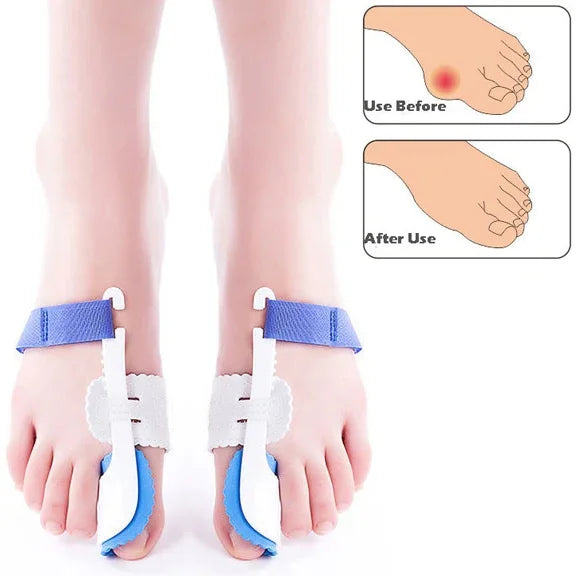 1 Pair ZRWC14 Bunio Night Splint Straightener, ZRWC14