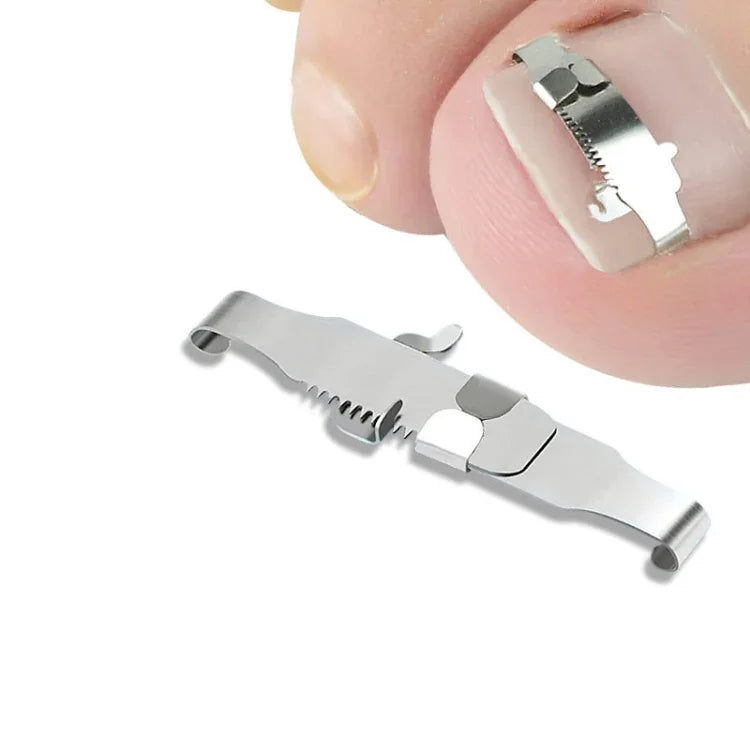 Orthopedic Buckle Toe Nail Groove Ingrown Nail Corrector, No. 36 Positive Nail Buckle, No. 38 Positive Nail Buckle, No. 40 Positive Nail Buckle, No. 42 Positive Nail Buckle, No. 44 Positive Nail Buckle, No. 36 Set, No. 38 Set, No. 40 Set, No. 42 Set   ...