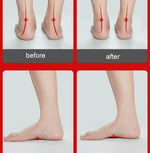 Flat Foot Orthopedic Insole Arch Collapse Support Pad Adult And Child Foot Valgus Orthosis, L (White)